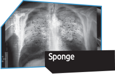 Sponge